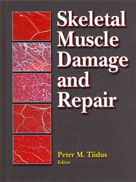 Skeletal muscle damage and repair /