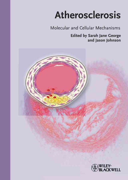 Atherosclerosis : molecular and cellular mechanisms /
