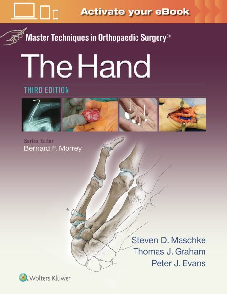 Master Techniques in Orthopaedic Surgery - the Hand