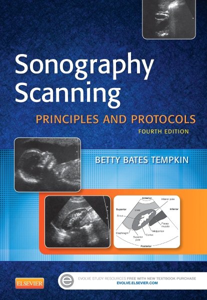 Sonography Scanning