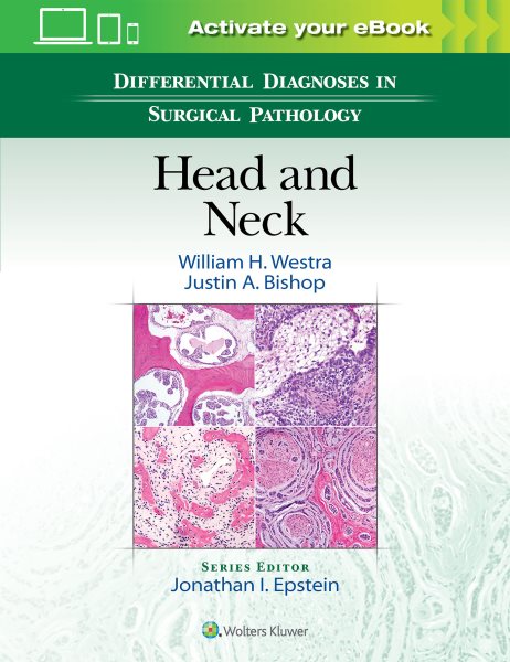 Differential Diagnoses in Surgical Pathology