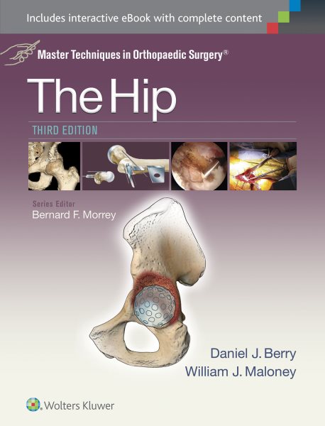 Master Techniques in Orthopedic Surgery - the Hip